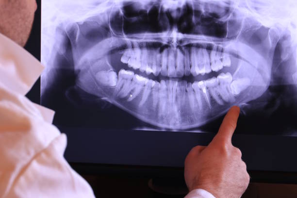 Best Emergency Dental Care for Broken or Chipped Teeth in Homestead Valley, CA
